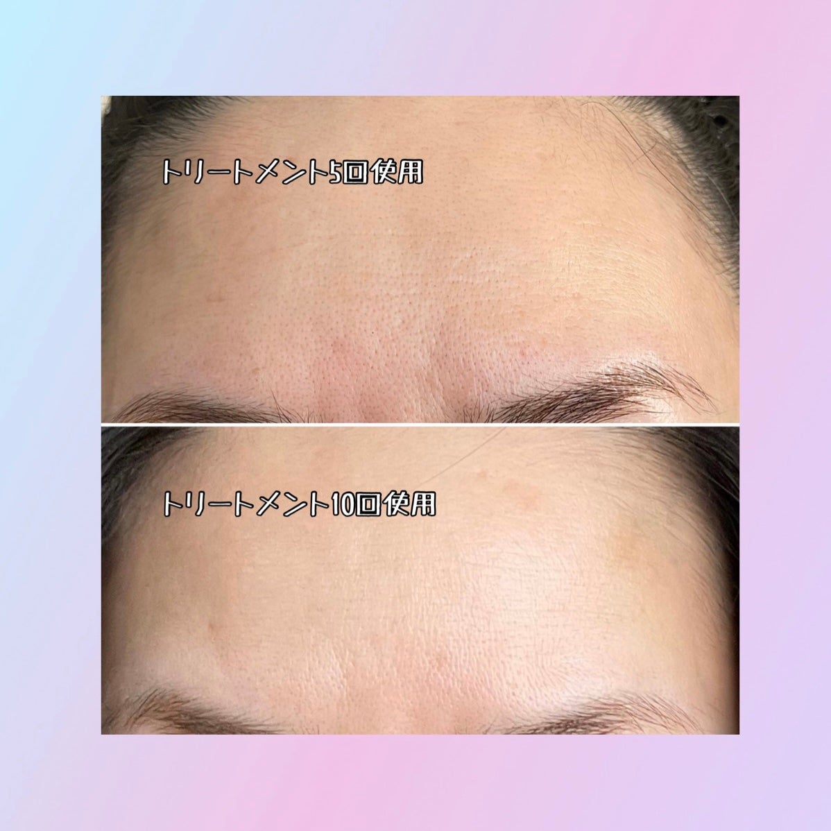 ibuharumaman on LIPS 「CurrentBodySkinLEDライトセラピーマスク付属品..」(10枚目)