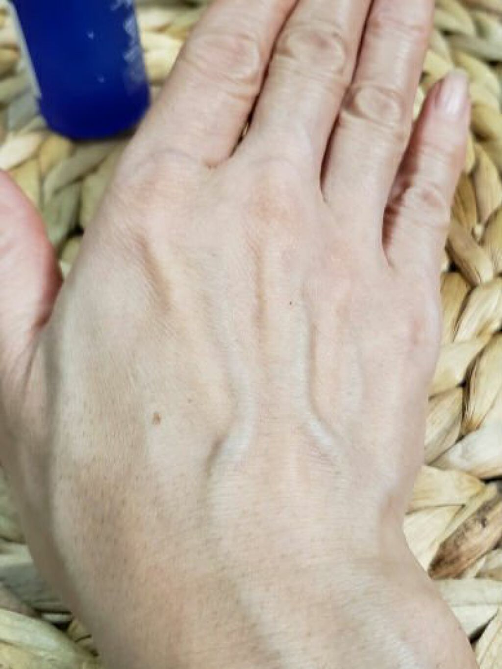 タカミスキンピール/タカミ/ブースター・導入液を使ったクチコミ(4枚目)