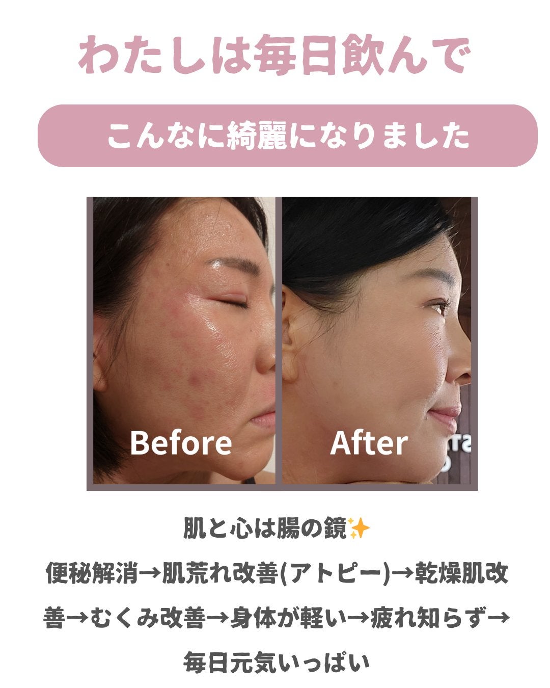 美肌カウンセラー💆肌悩みを解決し見る世界を変える on LIPS 「肌を綺麗にする専門家💆美肌カウンセラーおすすめ\肝臓のケアの奇..」(8枚目)