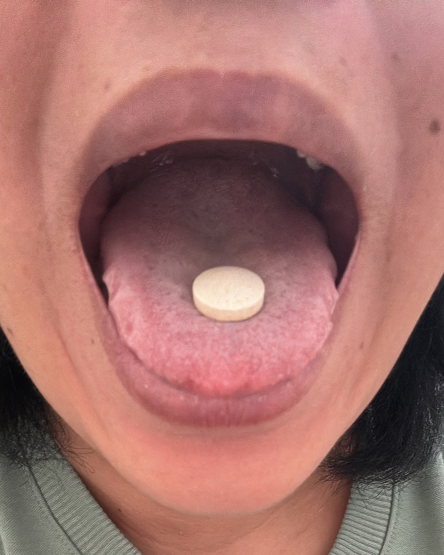 ブレスマイル/BRESMILE(ブレスマイル)/健康サプリメントを使ったクチコミ(5枚目)