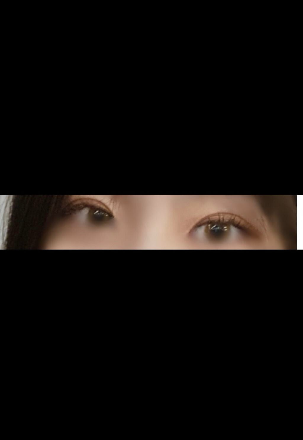 結友奈 on LIPS 「埋没永久保証埋没を決めたきっかけは圧倒的毎朝のアイプチのしんど..」(3枚目)