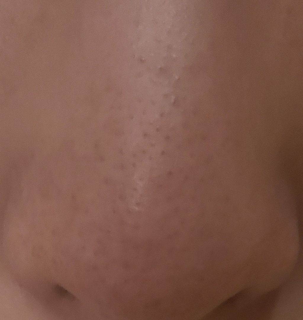 シラクル ビューティシート/Ciracle/トナーパッドを使ったクチコミ（2枚目）