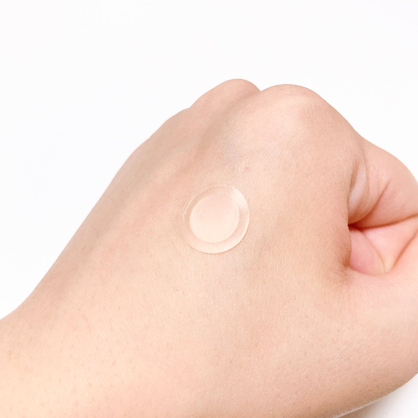 エーキュアショットスポットパッチ/obsero/にきびパッチを使ったクチコミ(5枚目)