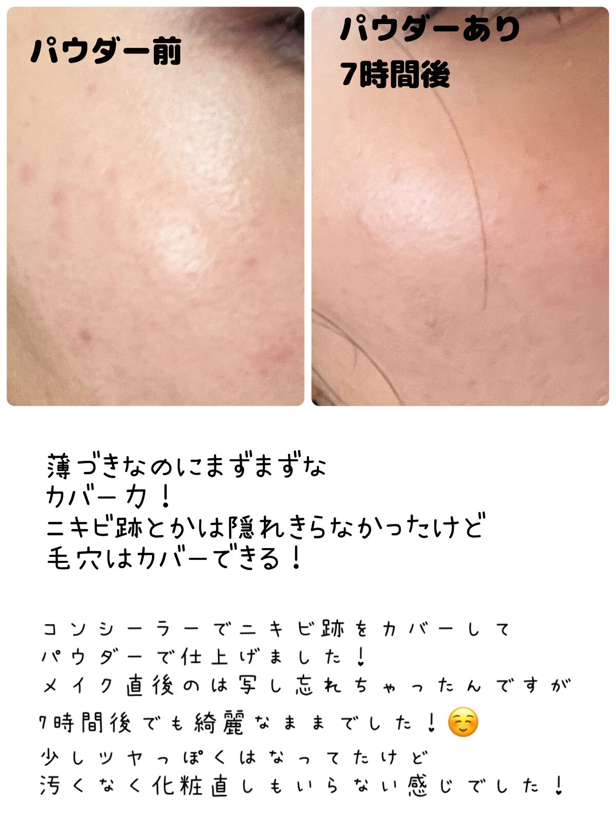 ナチュラルラディアント ロングウェア クッションファンデーション 5880/NARS/クッションファンデーションを使ったクチコミ（3枚目）