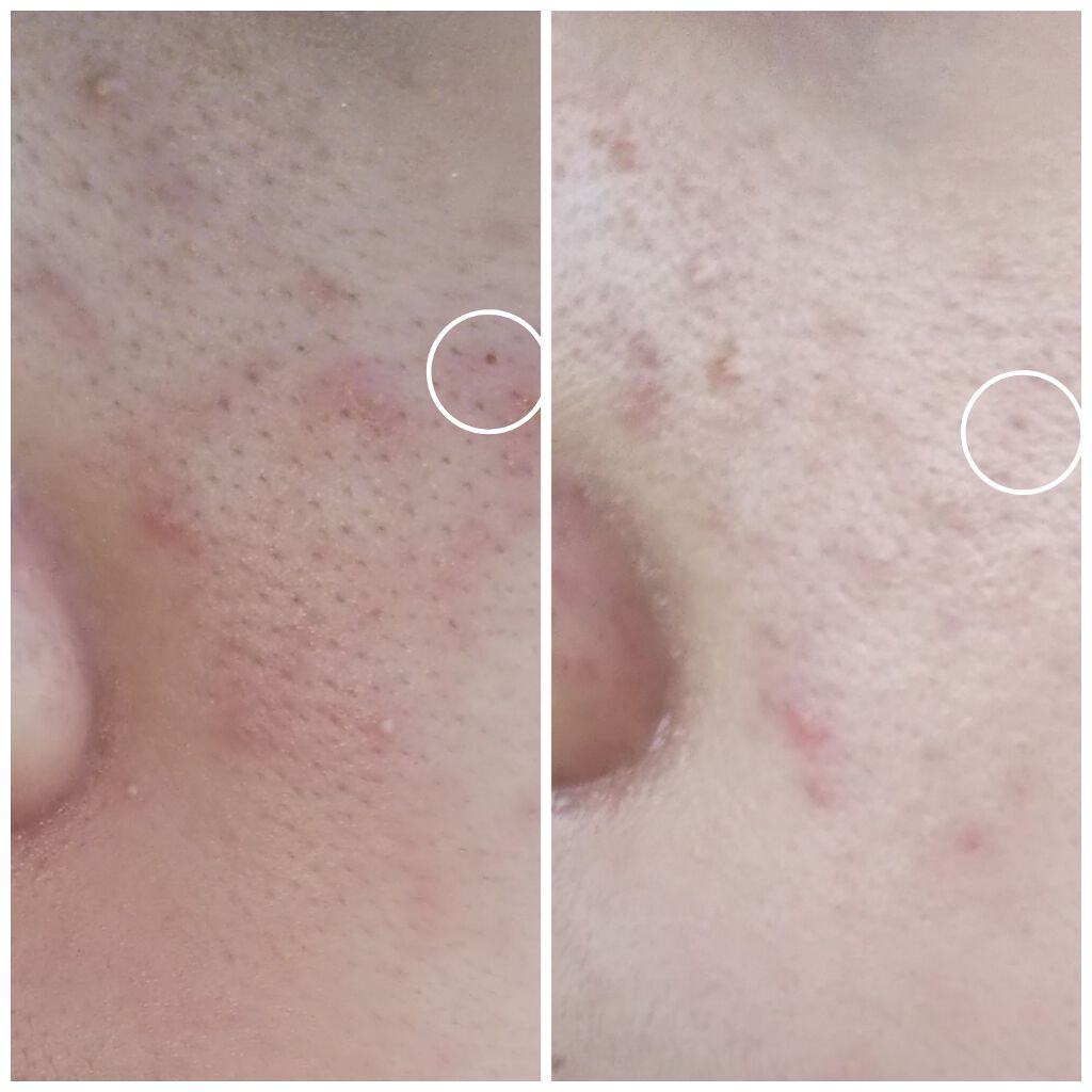 ウォッシャブル コールド クリーム/ちふれ/クレンジングクリームを使ったクチコミ(4枚目)