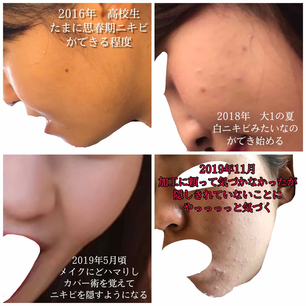 明色美顔水 薬用化粧水/美顔/化粧水を使ったクチコミ（2枚目）