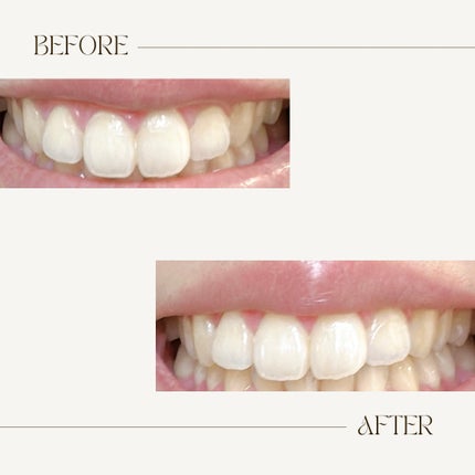 Dr.オーラル 薬用3Dホワイトニングペースト/Dr.Oral/歯磨き粉を使ったクチコミ(2枚目)