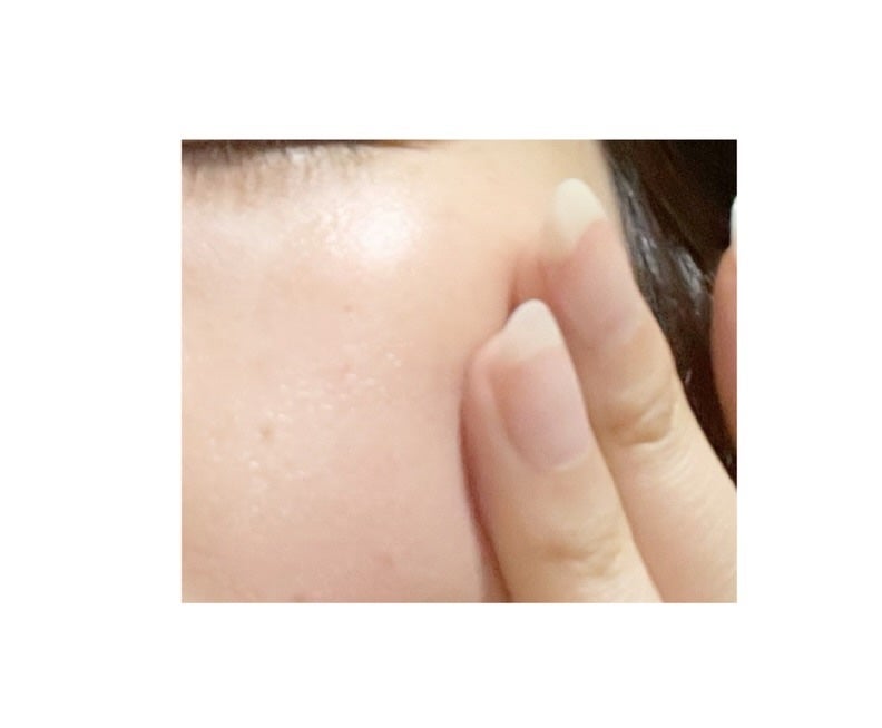 P.P.エッセンス/Euphoric/美容液を使ったクチコミ(4枚目)