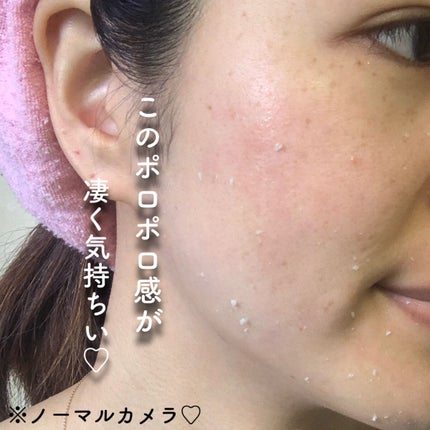 美白乃美人ピーリングジェル/ブレーンコスモス/ピーリングを使ったクチコミ(7枚目)