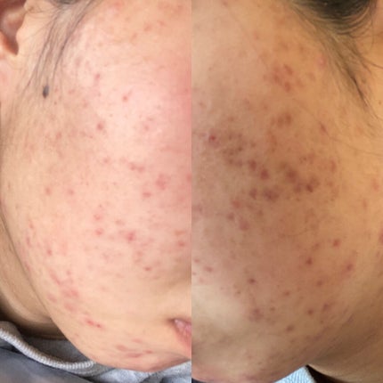 を使ったクチコミ(2枚目)