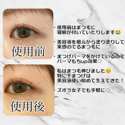 湘南美容まつ毛美容液/Co-medical+/まつげ美容液を使ったクチコミ(3枚目)