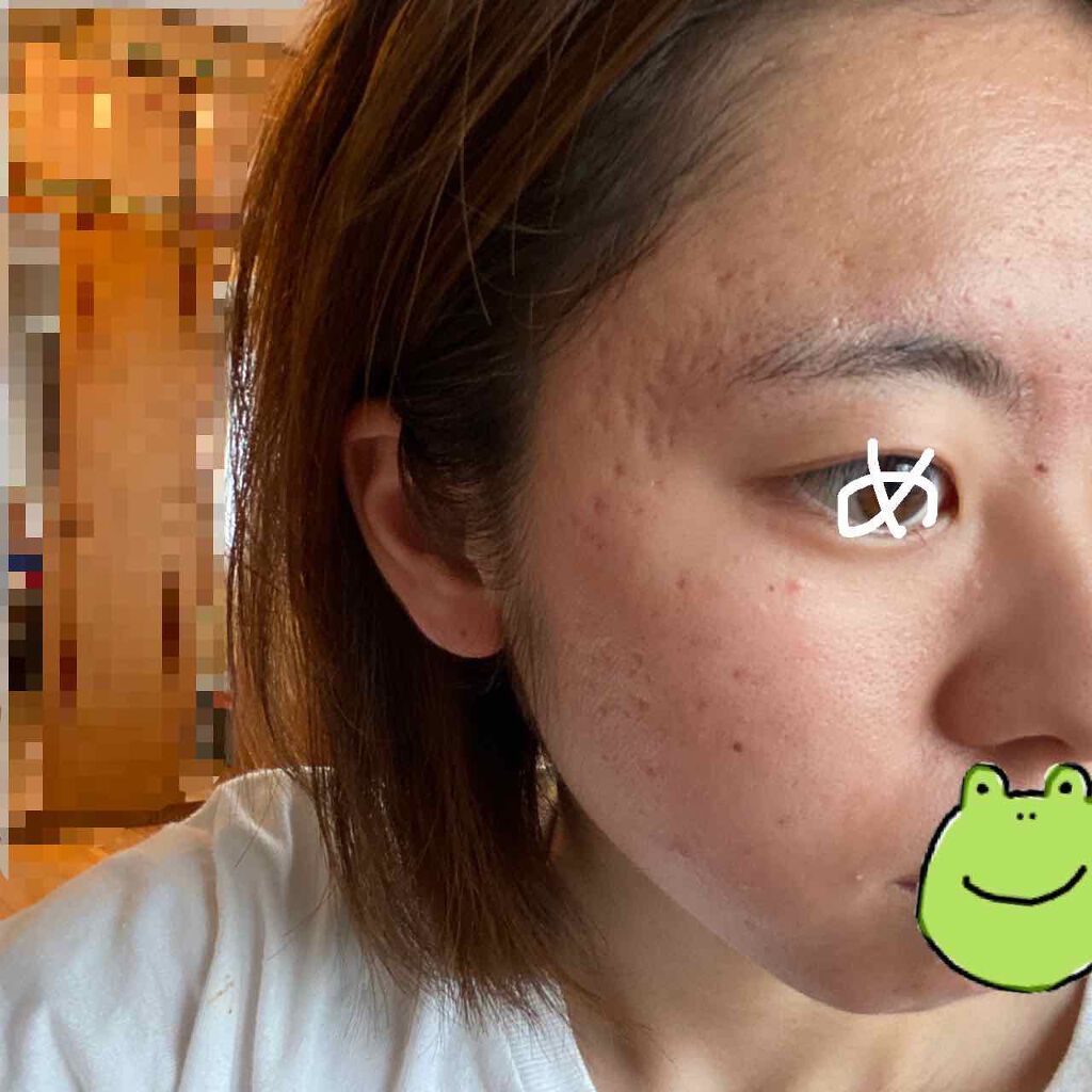極潤 ヒアルロン乳液 旧 肌ラボを使った口コミ かばおですこんにちは 肌断食やめてみました By かばお 混合肌 代前半 Lips