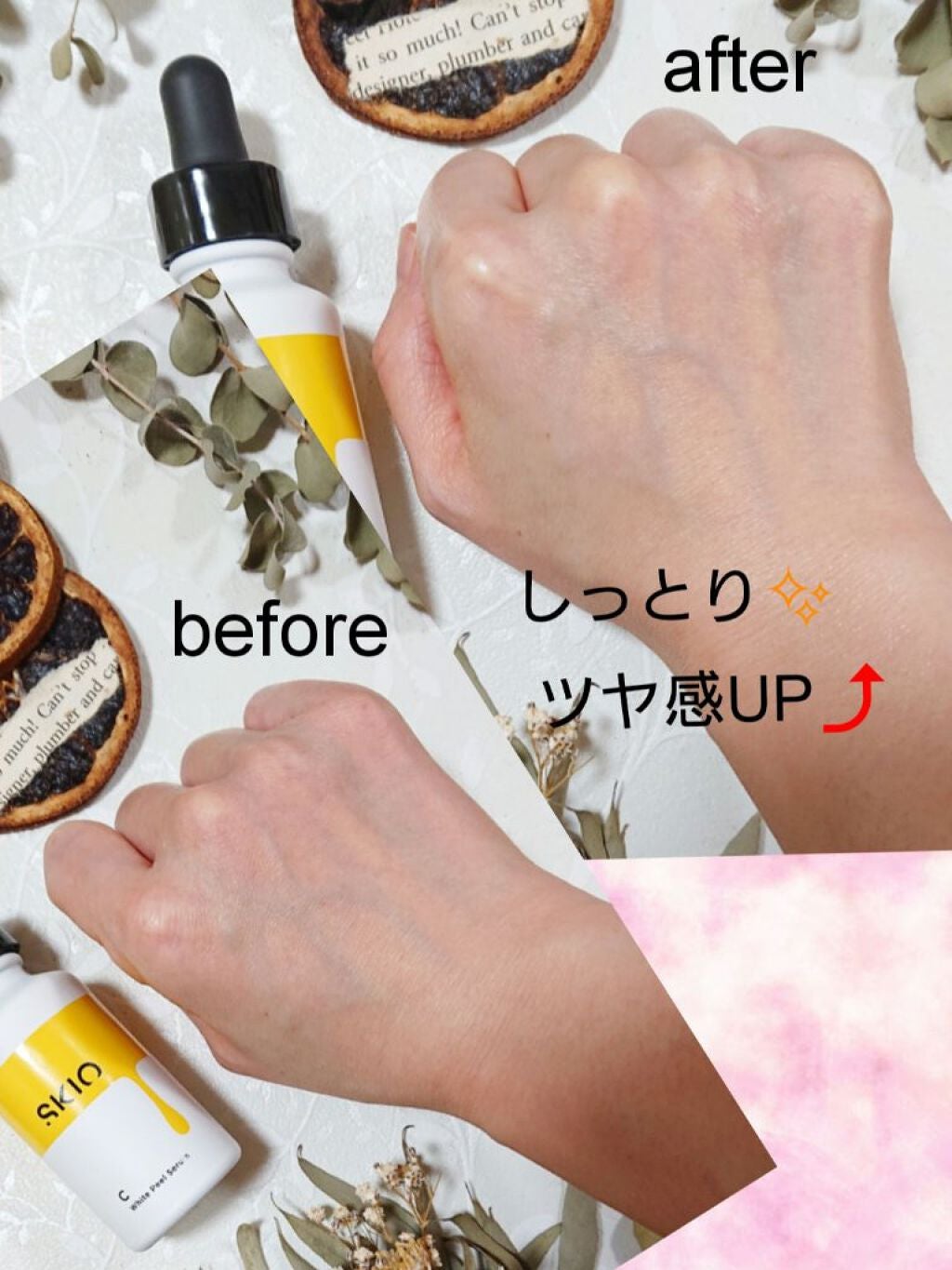 VC ホワイトピールセラム/SKIO/ブースター・導入液を使ったクチコミ(3枚目)