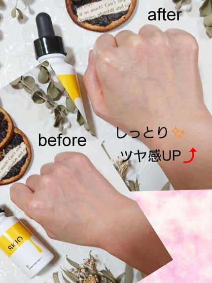 VC ホワイトピールセラム/SKIO/ブースター・導入液を使ったクチコミ(3枚目)