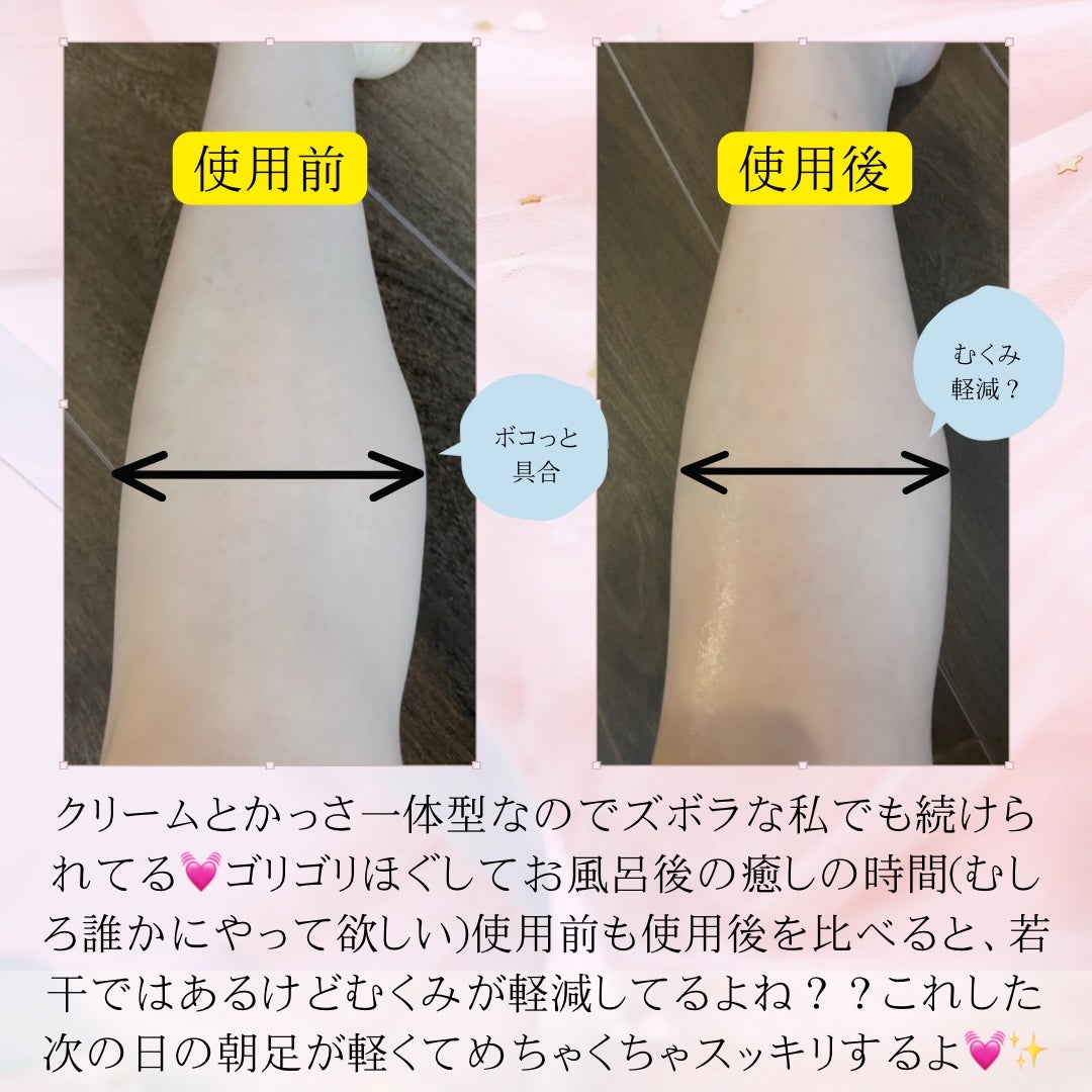 マグネシウムプラスエスシン ボディー かっさ マッサージ クリーム/b.clinicx/ボディクリームを使ったクチコミ(7枚目)