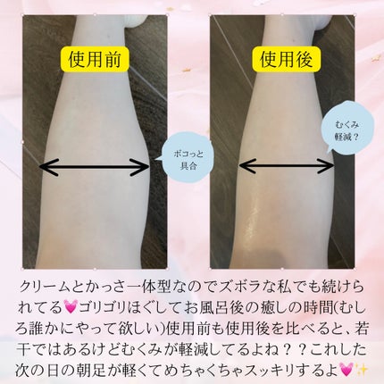 マグネシウムプラスエスシン ボディー かっさ マッサージ クリーム/b.clinicx/ボディクリームを使ったクチコミ(7枚目)