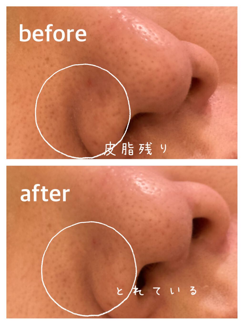 CICA カプセルマスク/VT/洗い流すパック・マスクを使ったクチコミ(7枚目)