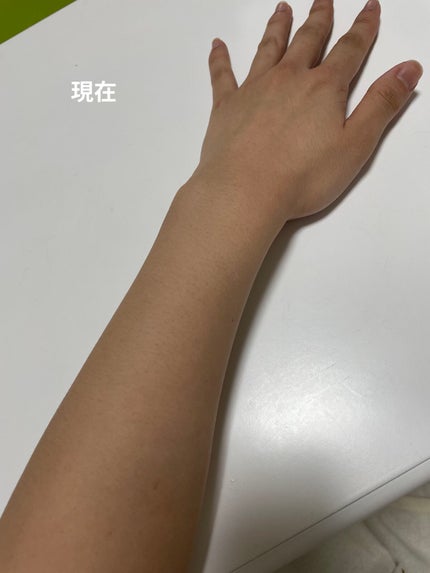 ビタミンC「2000」(医薬品)/武田薬品工業/健康サプリメントを使ったクチコミ(3枚目)