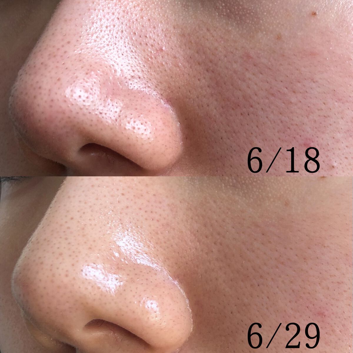 アンブリオリス モイスチャークリーム/アンブリオリス/フェイスクリームを使ったクチコミ（3枚目）