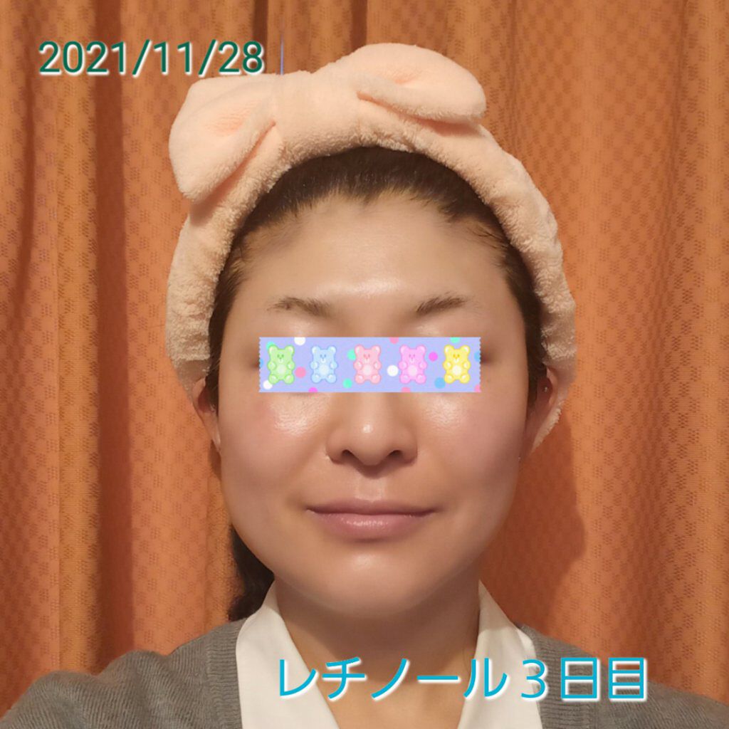 スーパーリンクルセラムVA/KISO/美容液を使ったクチコミ（1枚目）