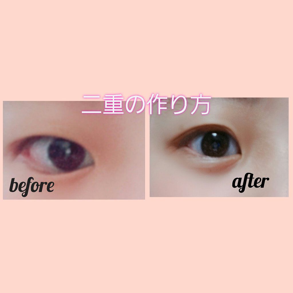 アイビューティー フィクサー WP/アストレア ヴィルゴ/二重まぶた用アイテムを使ったクチコミ（1枚目）