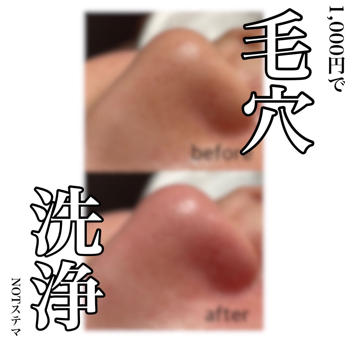 憫(びん) on LIPS 「【たった1000円! 毛穴が気になる方必見‼︎😳】 ⚠️bef..」(1枚目)