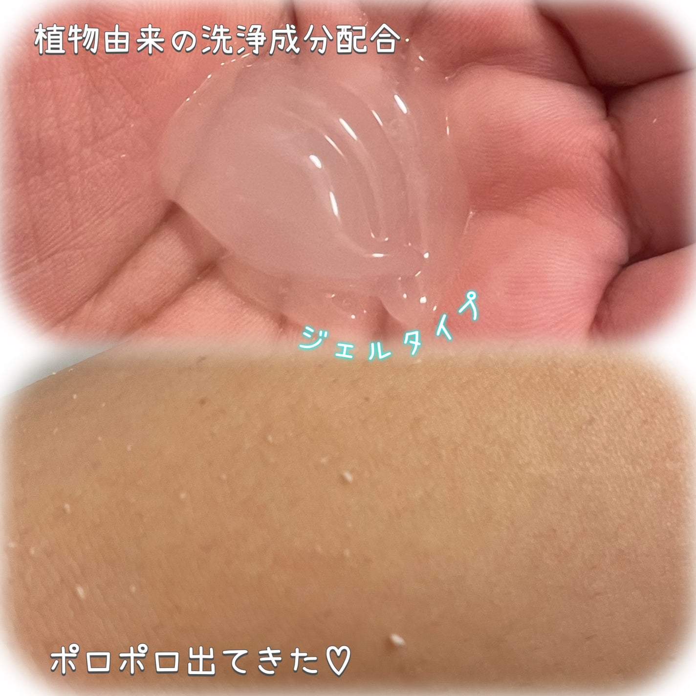 全身角質クリアゲル/NONON(ノンノン)/ピーリングを使ったクチコミ(2枚目)