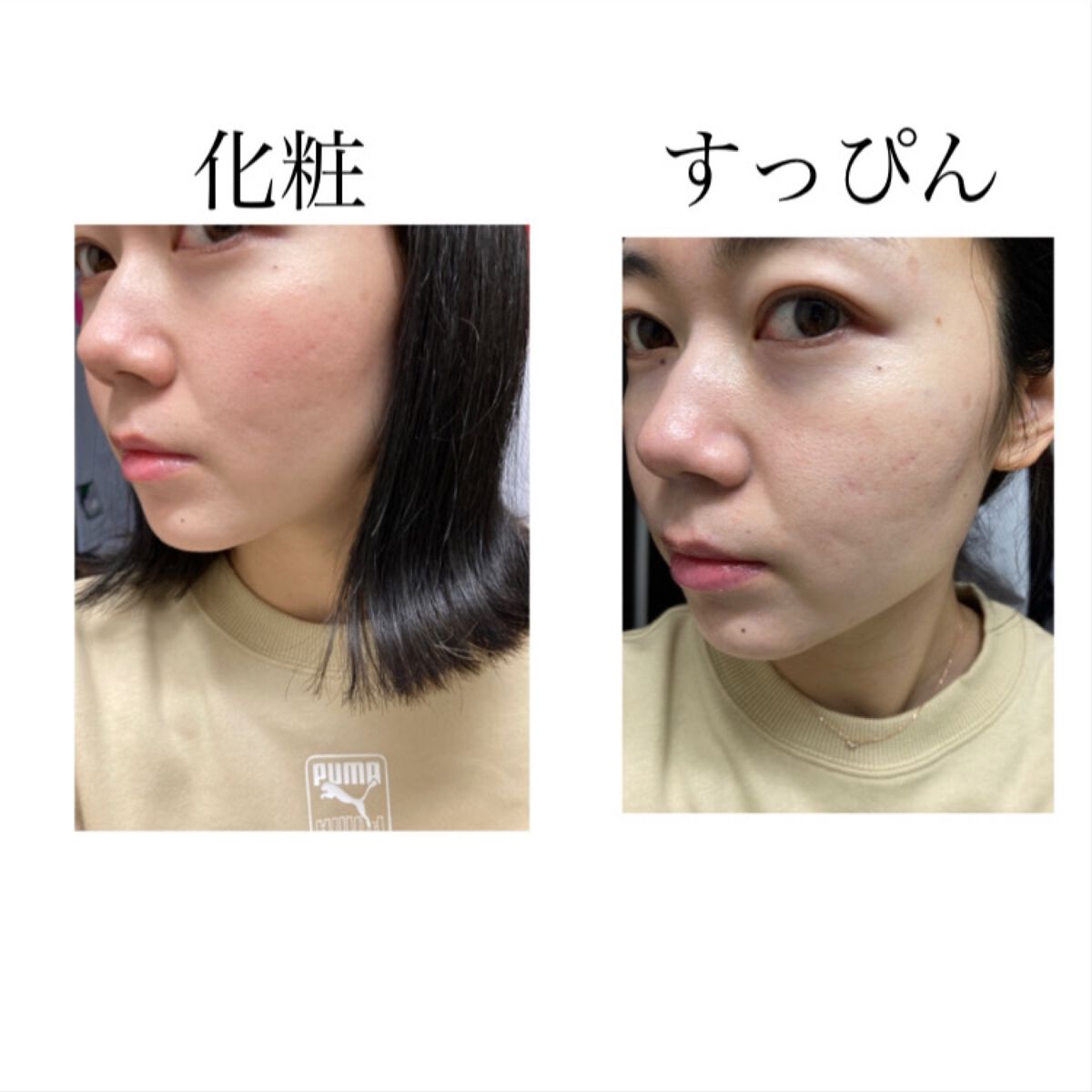 【旧】ディオールスキン フォーエヴァー スキン コレクト コンシーラー/Dior/リキッドコンシーラーを使ったクチコミ(2枚目)