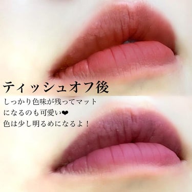 i.achan on LIPS 「お洒落顔にしたい時に使いまくってるティント❤︎【商品】MERZ..」（5枚目）