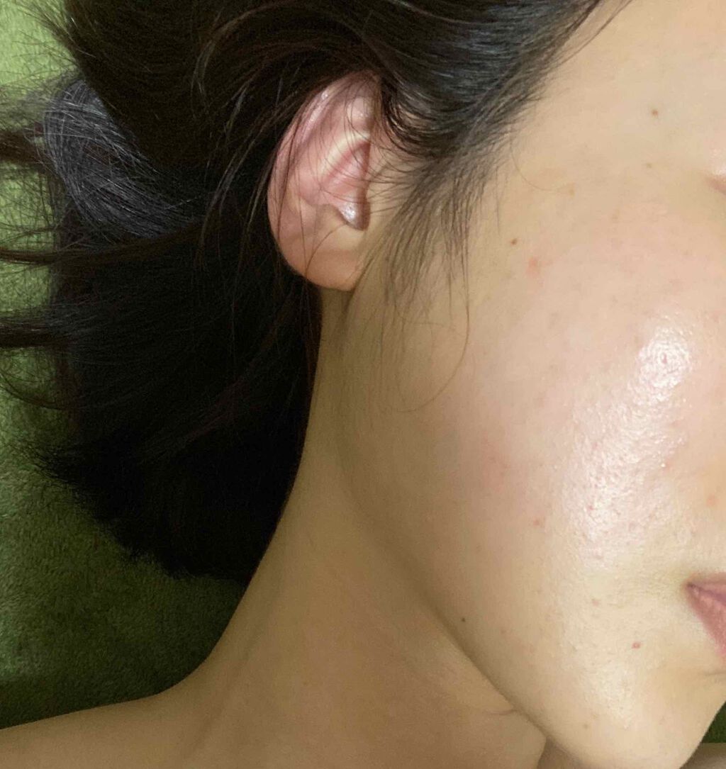 アルビオン 薬用スキンコンディショナー エッセンシャル/ALBION/化粧水を使ったクチコミ（1枚目）