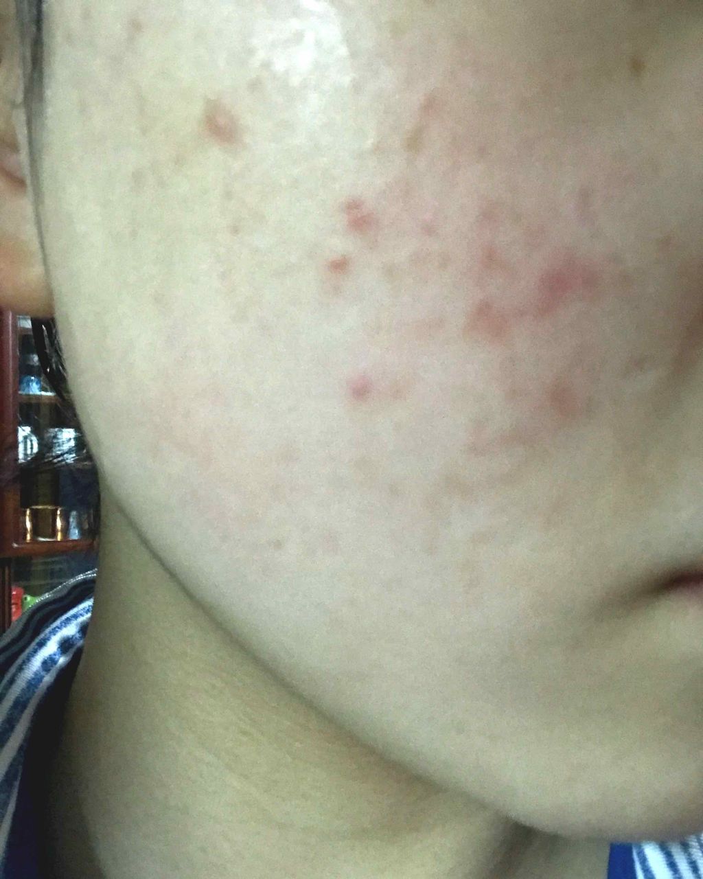 聖愛 on LIPS 「せなです✊🏻🌟お久しぶりの投稿となります!今回は私の肌事情につ..」(2枚目)