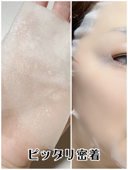 ダーマレーザー スーパー VC100 ホワイトマスク/クオリティファースト/シートマスク・パックを使ったクチコミ(4枚目)