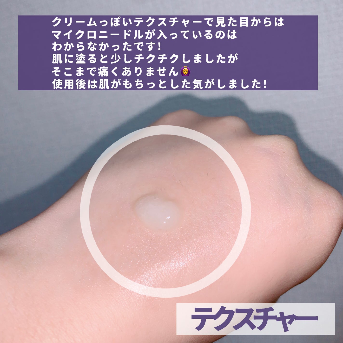 ビディ ニードルエッセンス NN/ビディ/美容液を使ったクチコミ(3枚目)