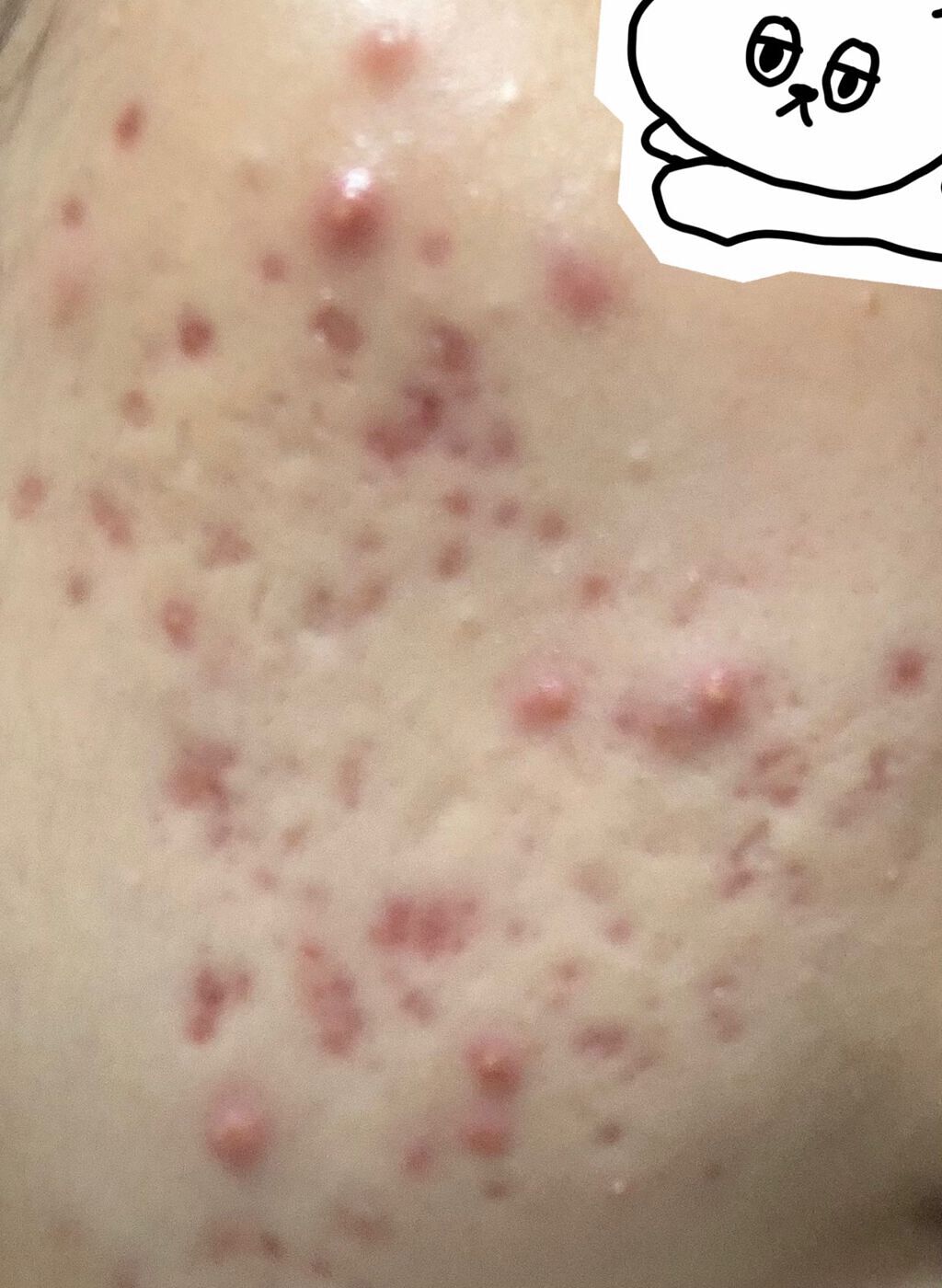 リシアル ミルクローション/メナード/乳液を使ったクチコミ(2枚目)