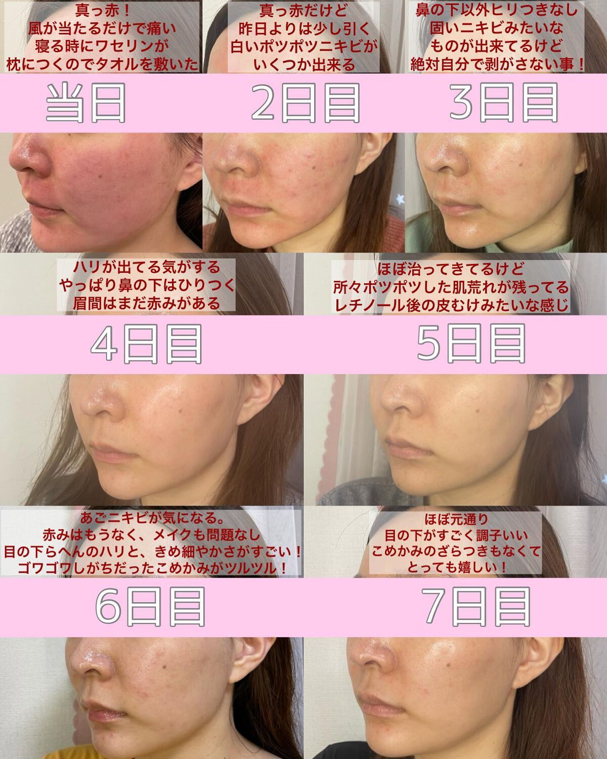 オリジナル ピュアスキンジェリー/ヴァセリン/ボディクリームを使ったクチコミ(3枚目)