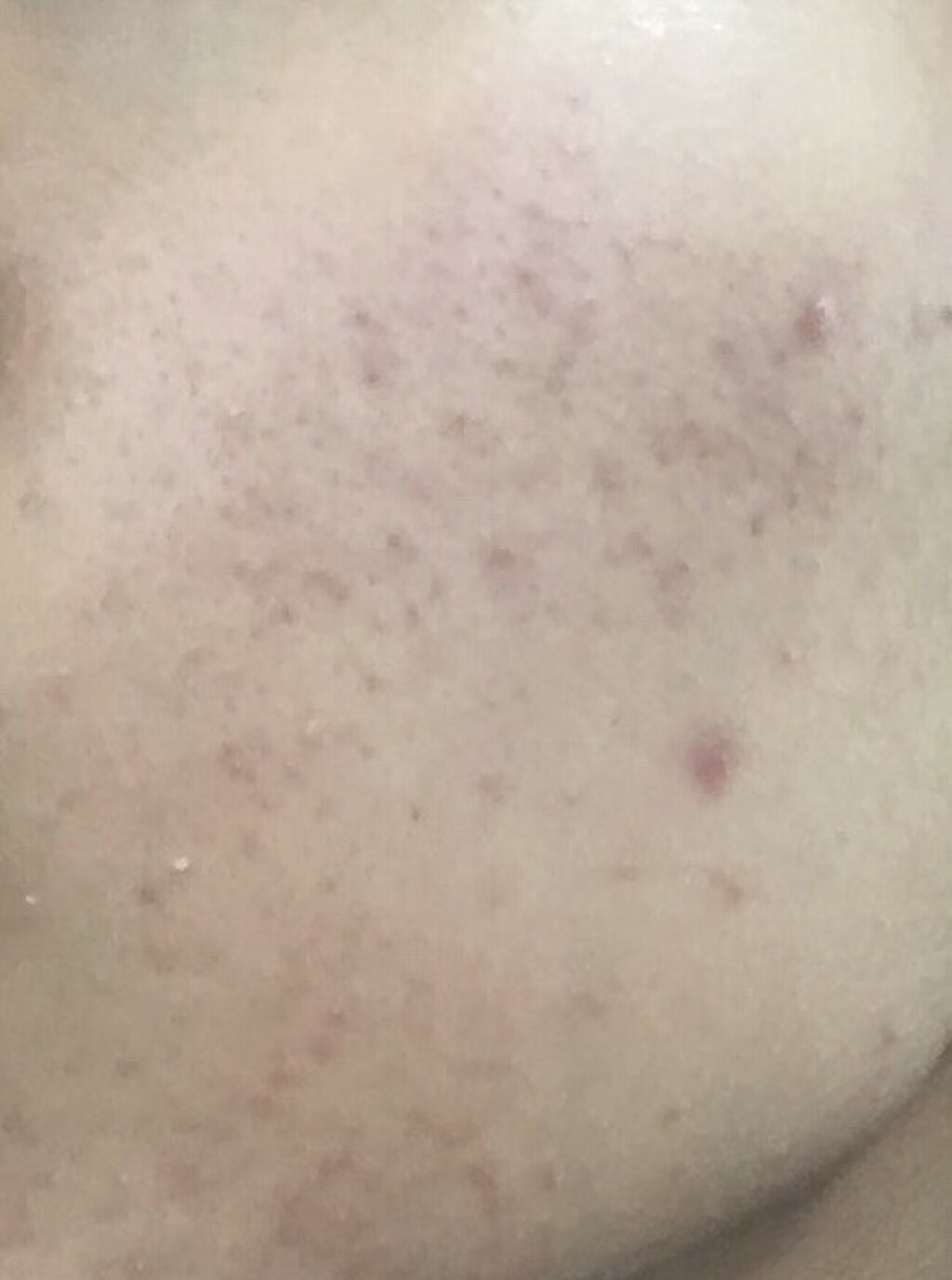 ロゼット洗顔パスタ 海泥スムース/ロゼット/洗顔フォームを使ったクチコミ（3枚目）