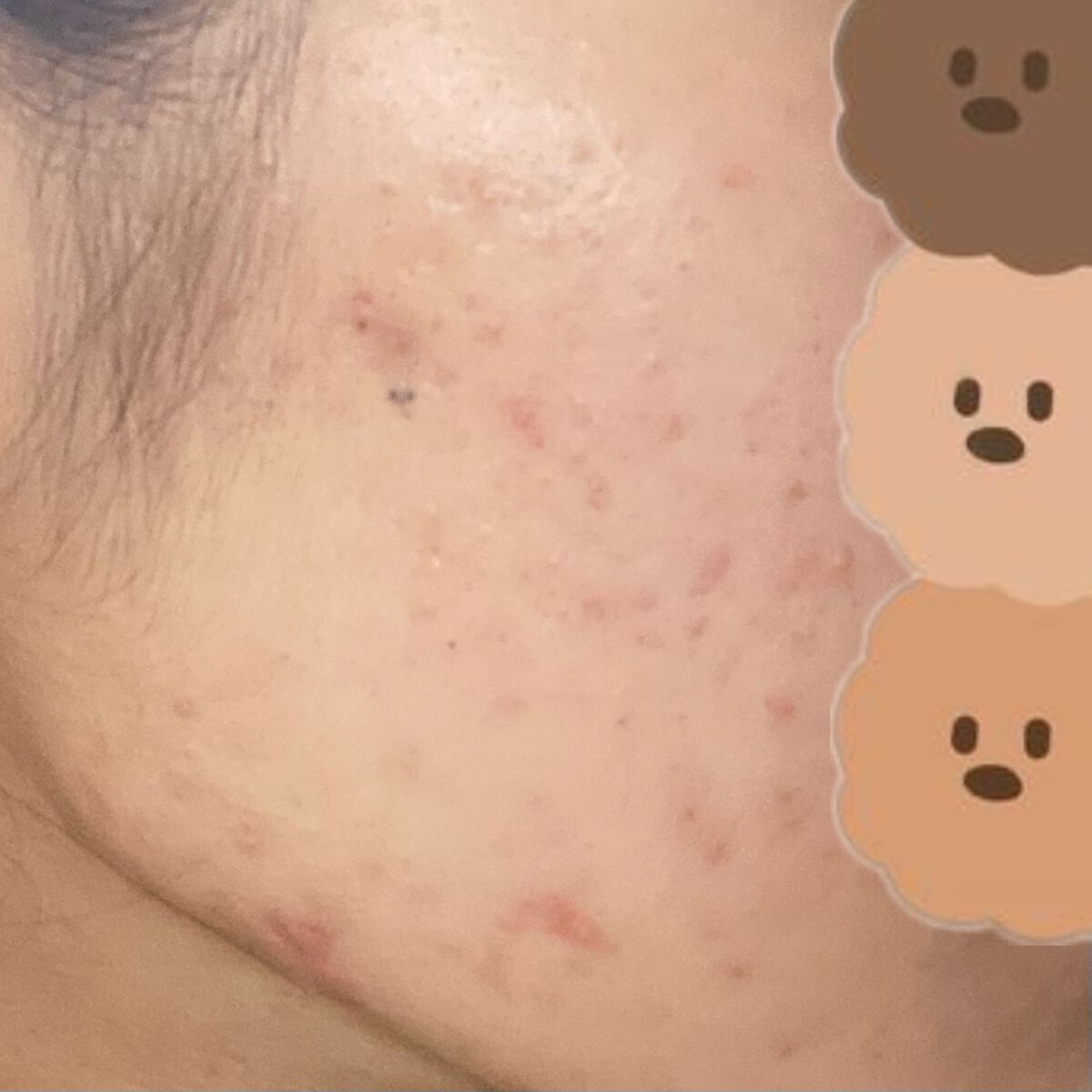 シカレチA エッセンス0.1/VT/美容液を使ったクチコミ(4枚目)