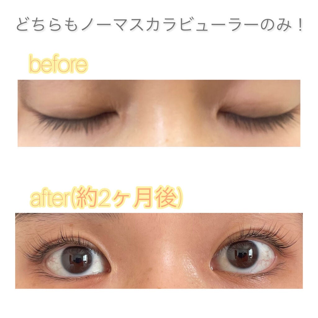 natsunhana フォロバ100! on LIPS 「めーーーーちゃくちゃのびたまつ毛美容液!!色素沈着もなかったで..」(1枚目)