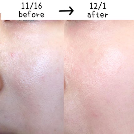 リードルショット クレンザー/VT/洗顔フォームを使ったクチコミ(2枚目)