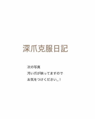 ネイルトリートメント N/ネイルネイル/ネイルオイル・トリートメントを使ったクチコミ（1枚目）