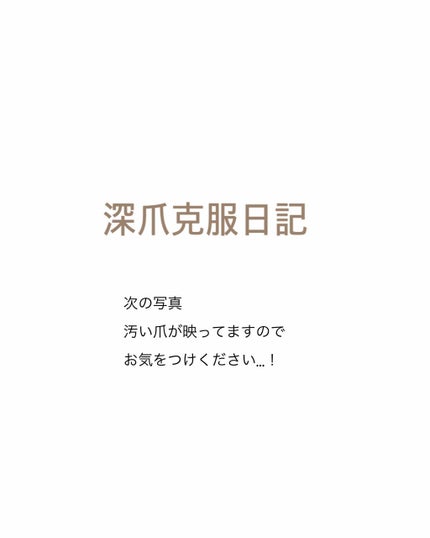 エテュセ クイックケアコート/ettusais/ネイルオイル・トリートメントを使ったクチコミ(1枚目)