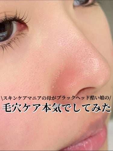 アドバンス ナイト リペア SMR コンプレックス/ESTEE LAUDER/美容液を使ったクチコミ（1枚目）