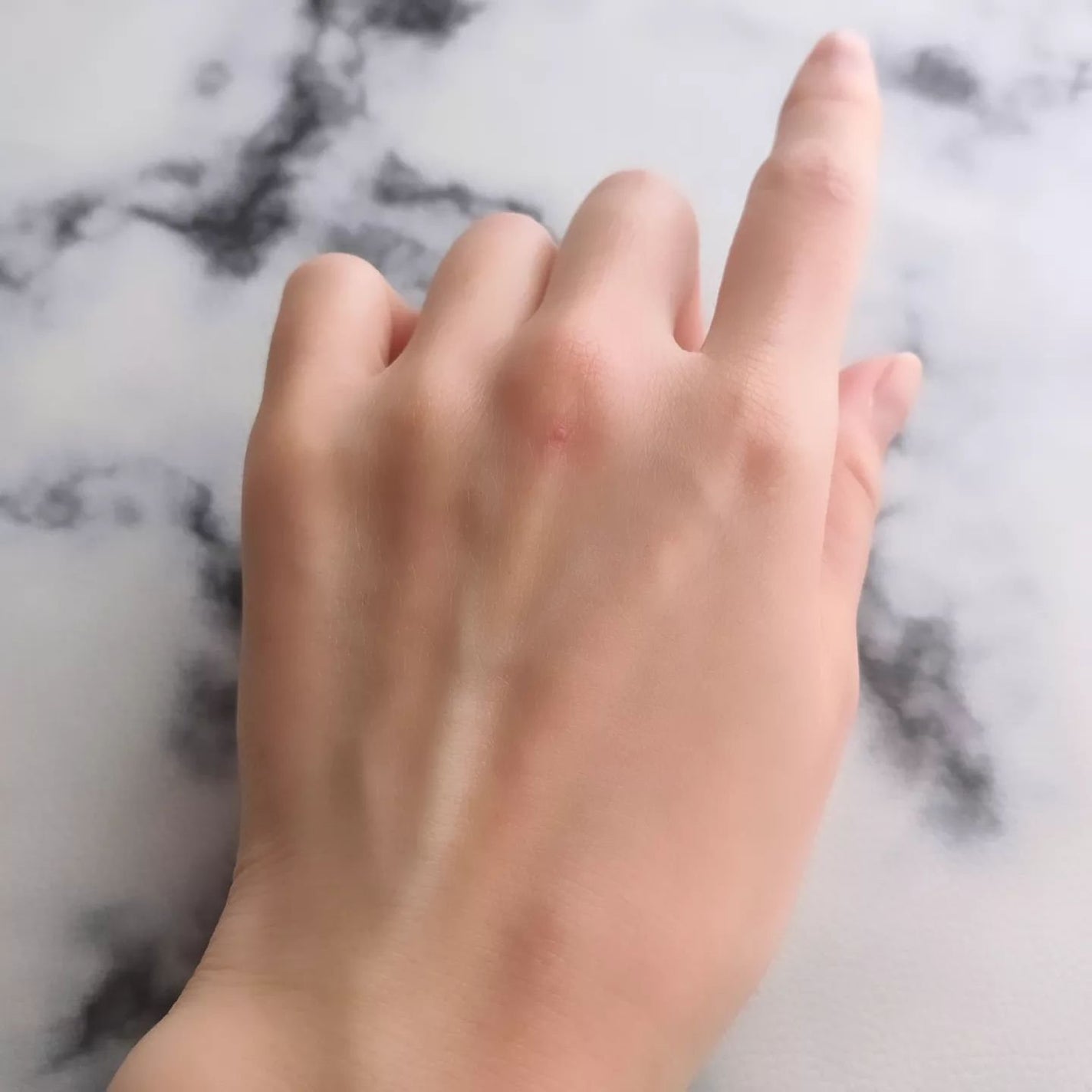 薬用リンクルホワイト デイ&ナイト セラム/明色/美容液を使ったクチコミ(4枚目)