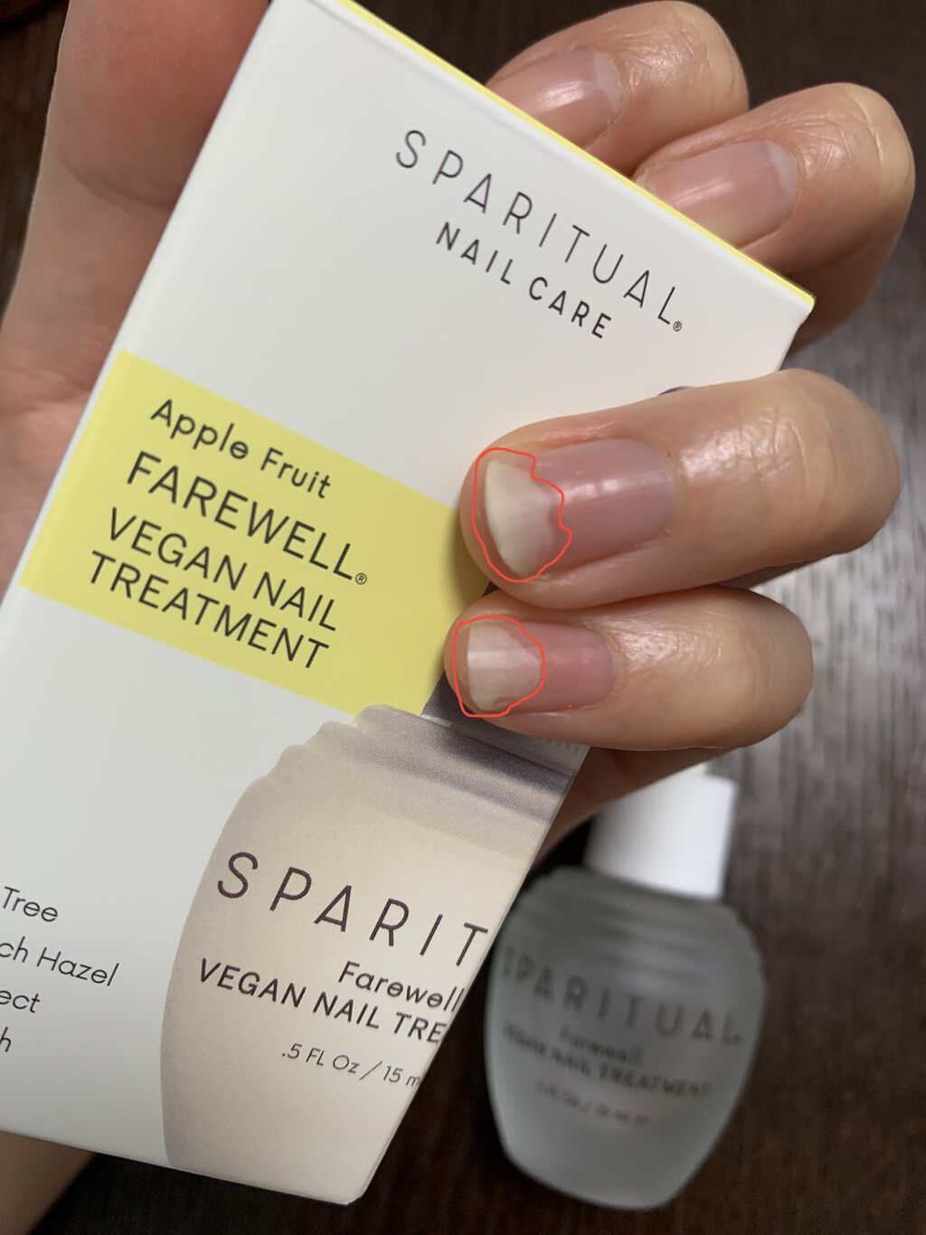 ありちゃのクチコミ「５/５追加
薬指気にならないぐらいに伸びた。
小指は半分ぐらい剥離消失した。

爪の表面凸凹し.....」（1枚目）