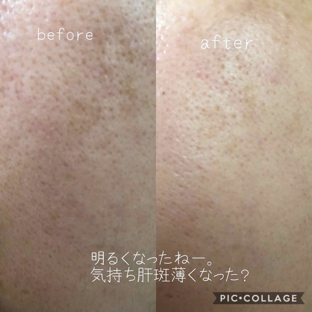 メラノショット ホワイト D/ONE BY KOSE/美容液を使ったクチコミ(2枚目)