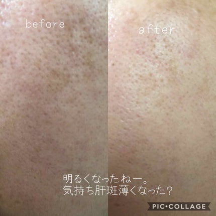 メラノショット ホワイト D/ONE BY KOSE/美容液を使ったクチコミ(2枚目)