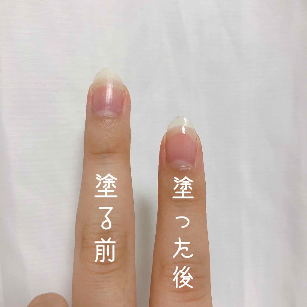 ネイルセラム/innisfree/ネイルオイル・トリートメントを使ったクチコミ(2枚目)