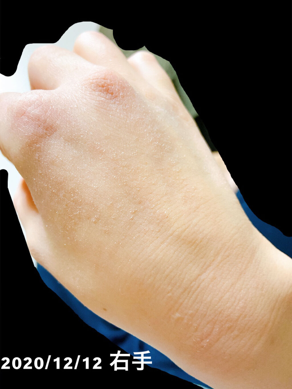 薬用ハンド＆フィンガー/ヴァセリン/ハンドクリームを使ったクチコミ（3枚目）