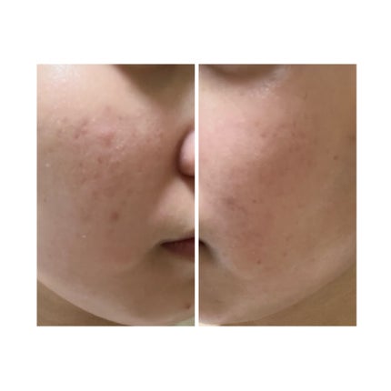 を使ったクチコミ(1枚目)