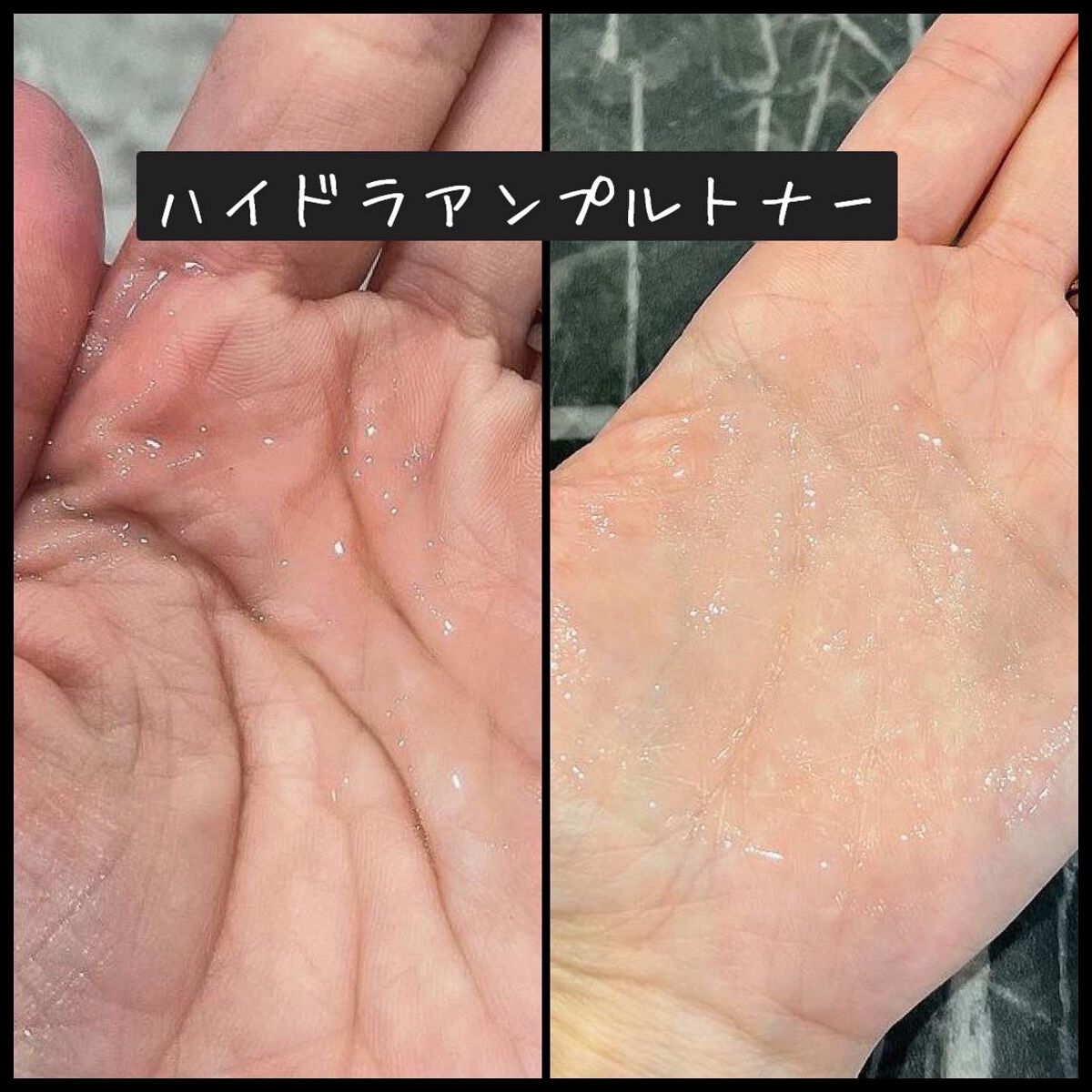 ハイドラアンプルトナー/9Wishes/化粧水を使ったクチコミ（2枚目）